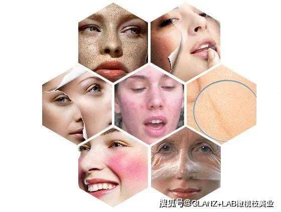 怎么才能让皮肤变好学生党,怎么才能让皮肤变好变亮