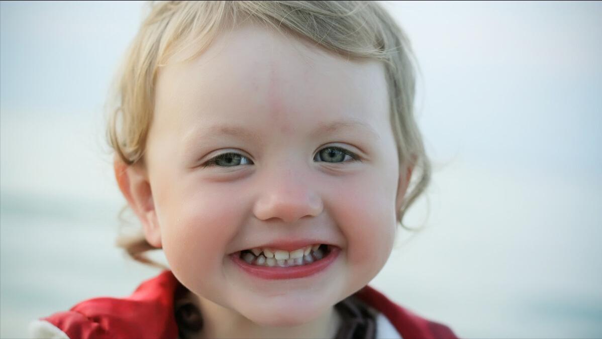 孩子身上的胎记是血管瘤吗,儿童面部红斑胎记