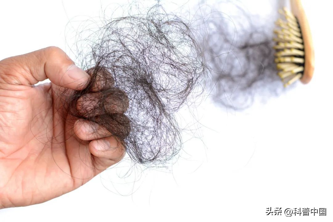 最近总是掉头发是怎么回事,老是掉头发是身体出现问题吗