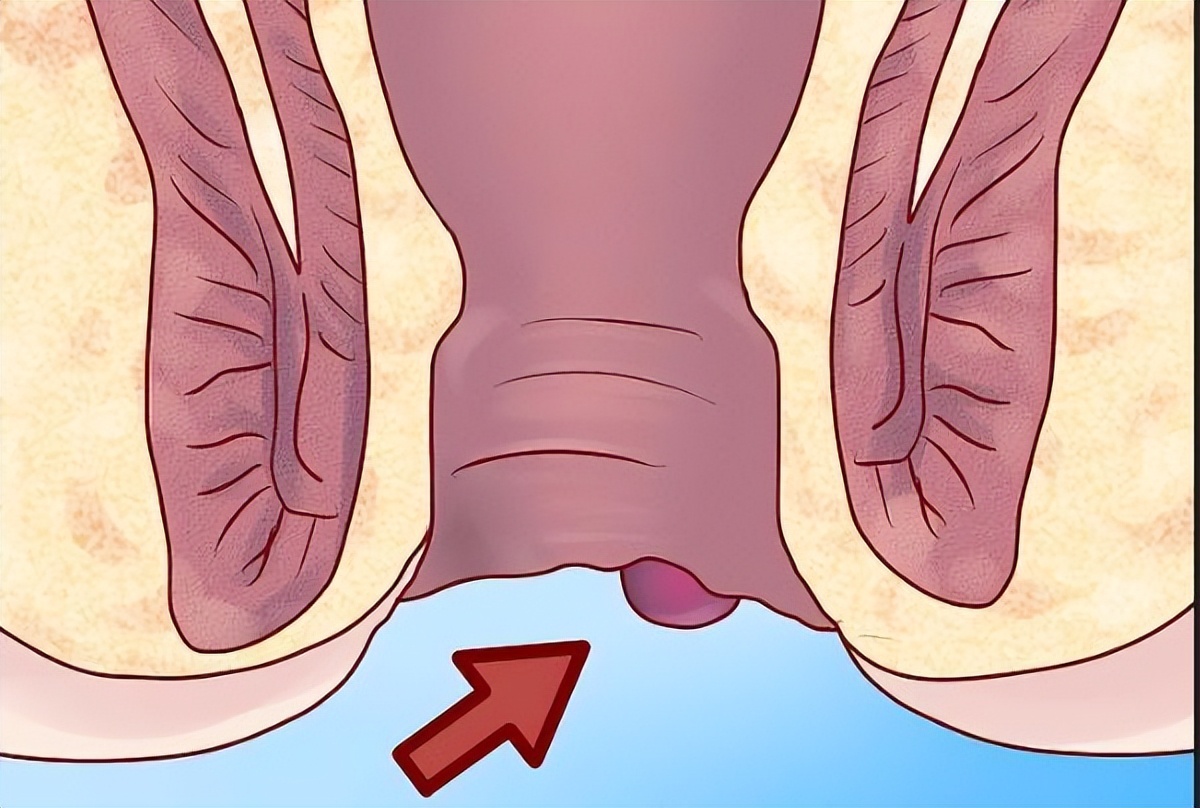 你有洗屁股的习惯吗,你有洗冷水澡的习惯吗