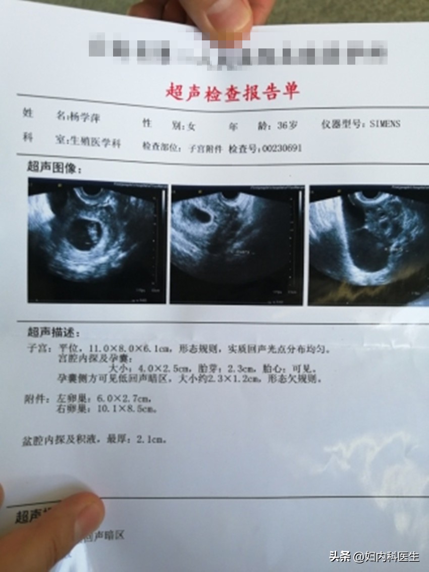 盆腔积液达到多少才需要治疗,女性盆腔积液腹痛用什么药最好