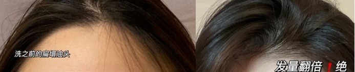 孕期好用的洗发水推荐,适合孕期使用的洗发水推荐