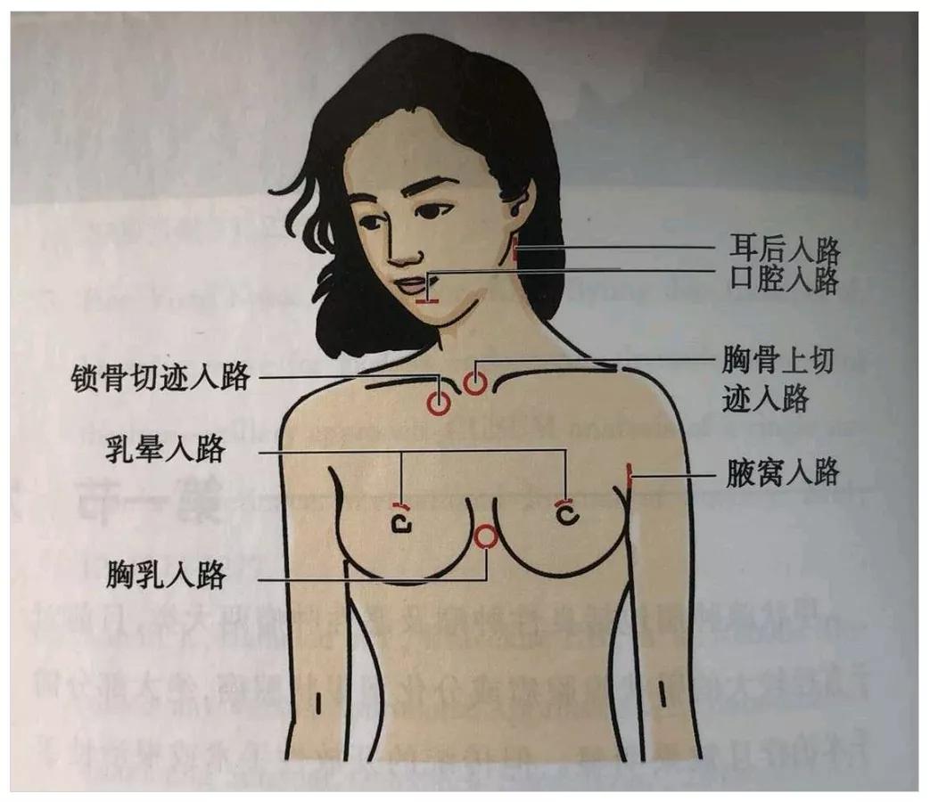 i甲小百科——二十六岁女星自曝接受甲状腺手术，其中有何内情？