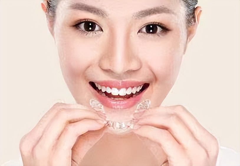 戴牙套会变好看还是丑,戴牙套会不会改变脸型