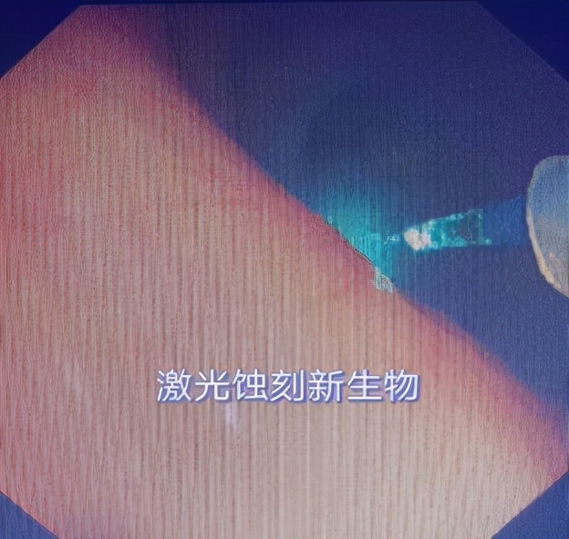 哈医大一院气管镜,哈医大群力呼吸内科