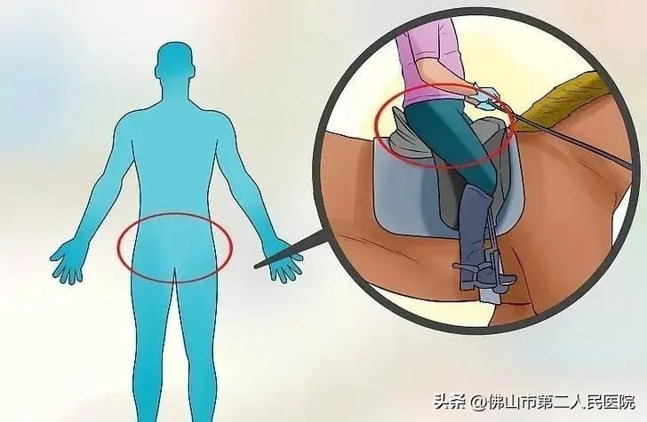 二十几岁腰椎间盘突出,二十几岁为什么会腰间盘突出