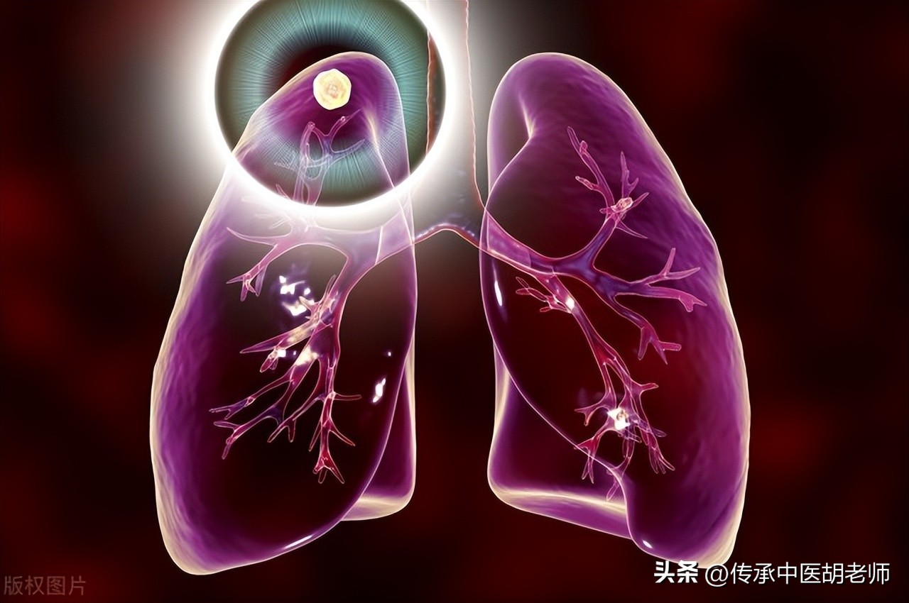 逍遥丸配一物，不仅疏肝解郁，还可治这4种病，建议收藏！