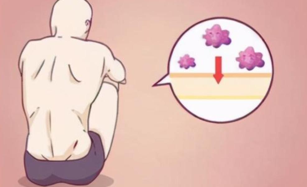 可以不通过性传播的疾病有哪些,非性传播疾病