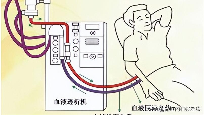 增强ct用造影剂对肾脏影响有多大,增强血管ct检查对人有伤害吗