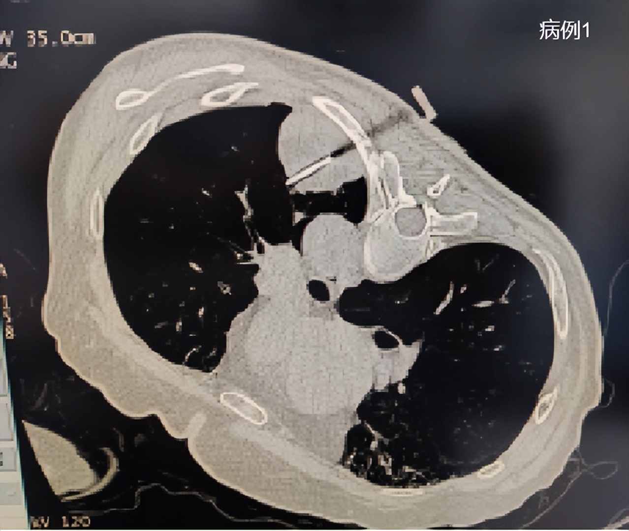 沈阳医学院第二附属医院,沈阳医学院附属第二医院退役军人