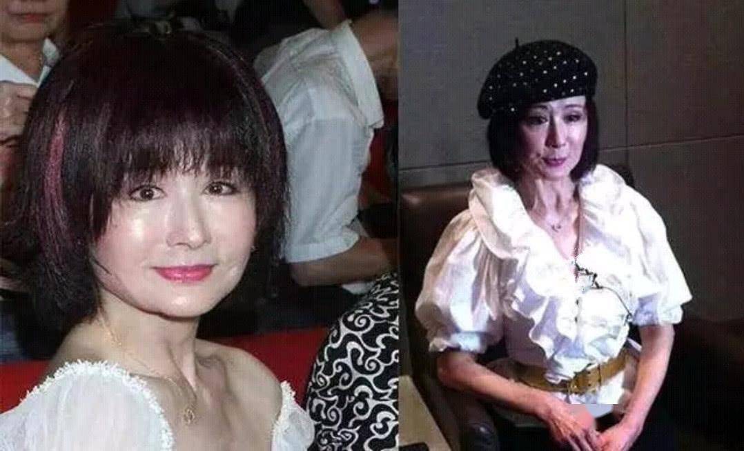 没了美颜滤镜，谁在装嫩一目了然，麒麟臂、水桶腰、满脸皱纹沟壑