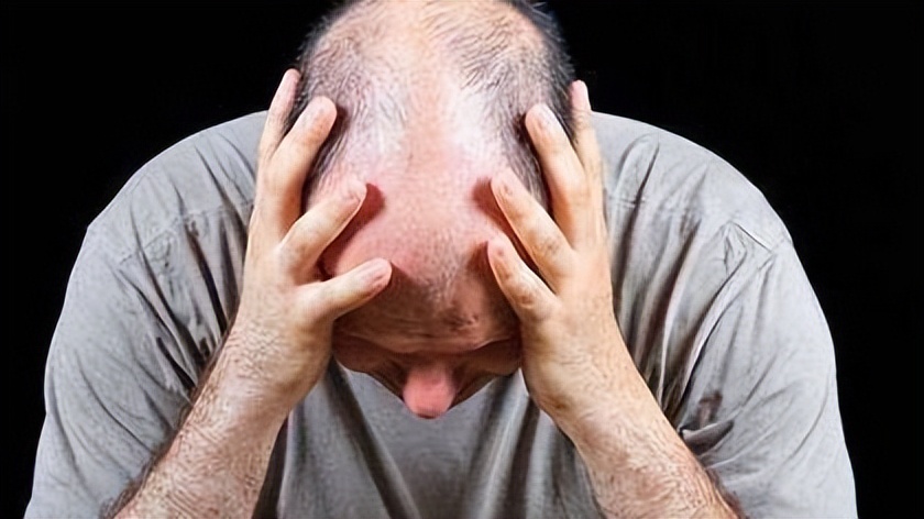 脱发为什么都是从头顶先秃,脱发为什么先从头顶脱