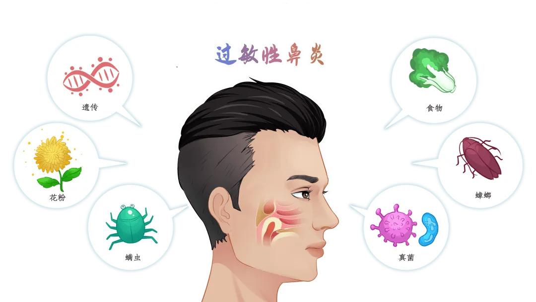 过敏性鼻炎流鼻涕鼻塞怎么办,孩子鼻塞过敏性鼻炎怎样快速解决