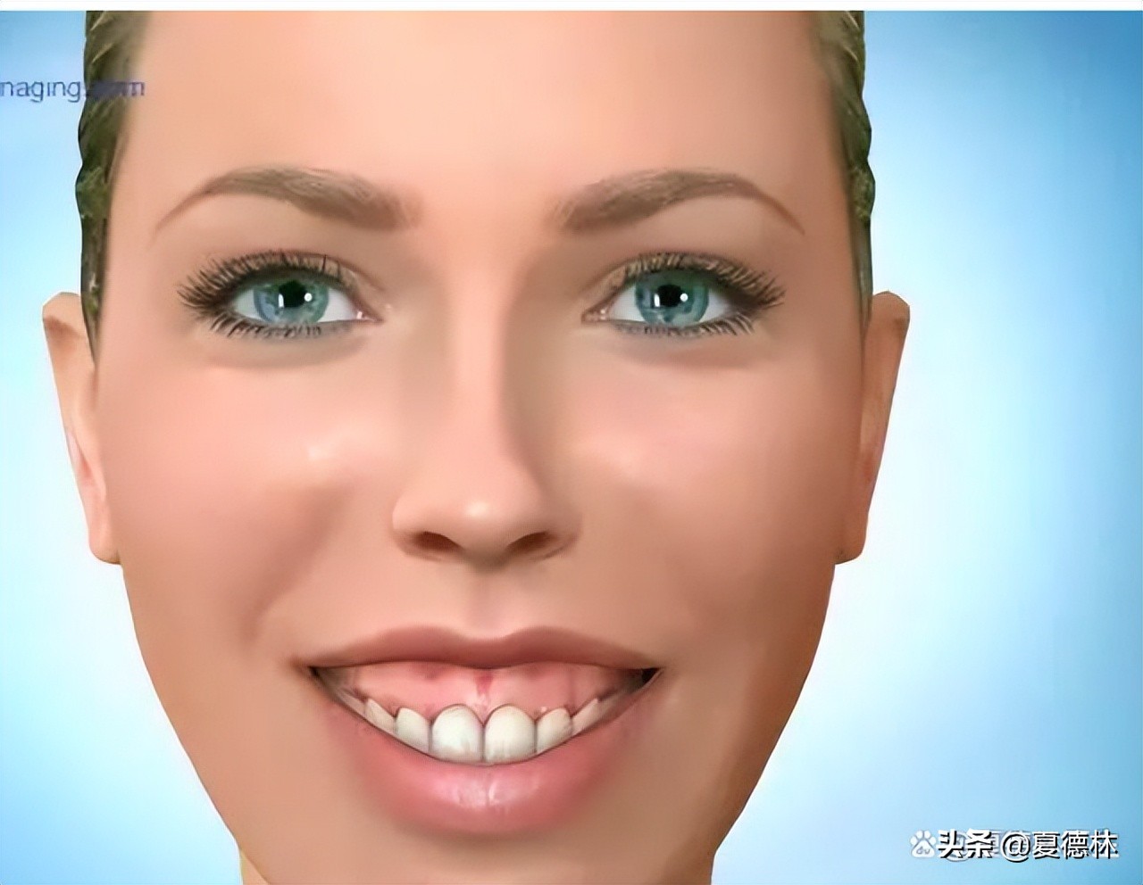 笑露牙龈怎么通过日常改善,为什么有些人笑起来露牙龈