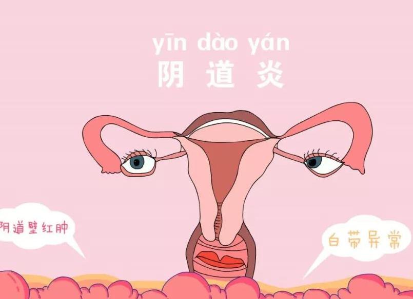 30岁的女人患上了阴道松弛，老公都不愿意碰她！怎么办？