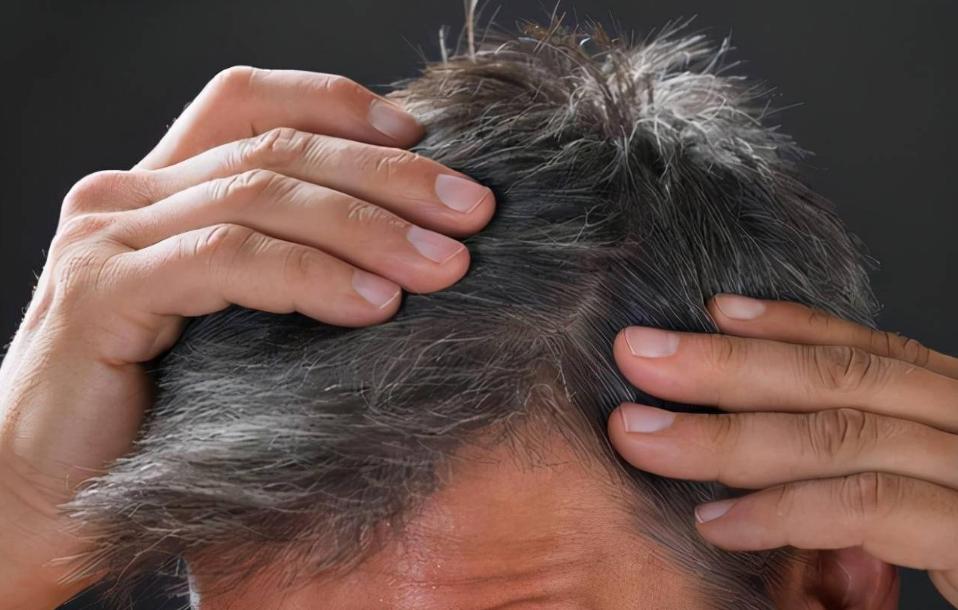 长白发的原因和解决方法,30岁突然长白发什么原因