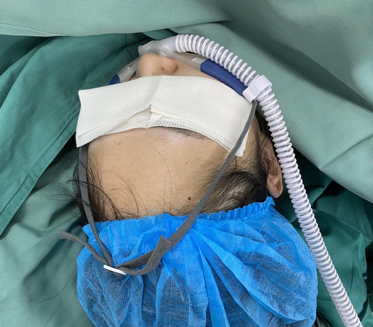 高流量吸氧感受,高流量吸氧技术是什么