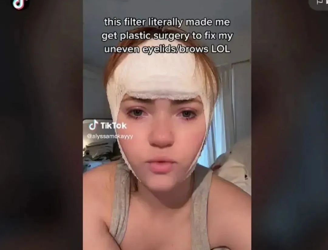 卡戴珊身体整形,卡戴珊做了哪些整容手术