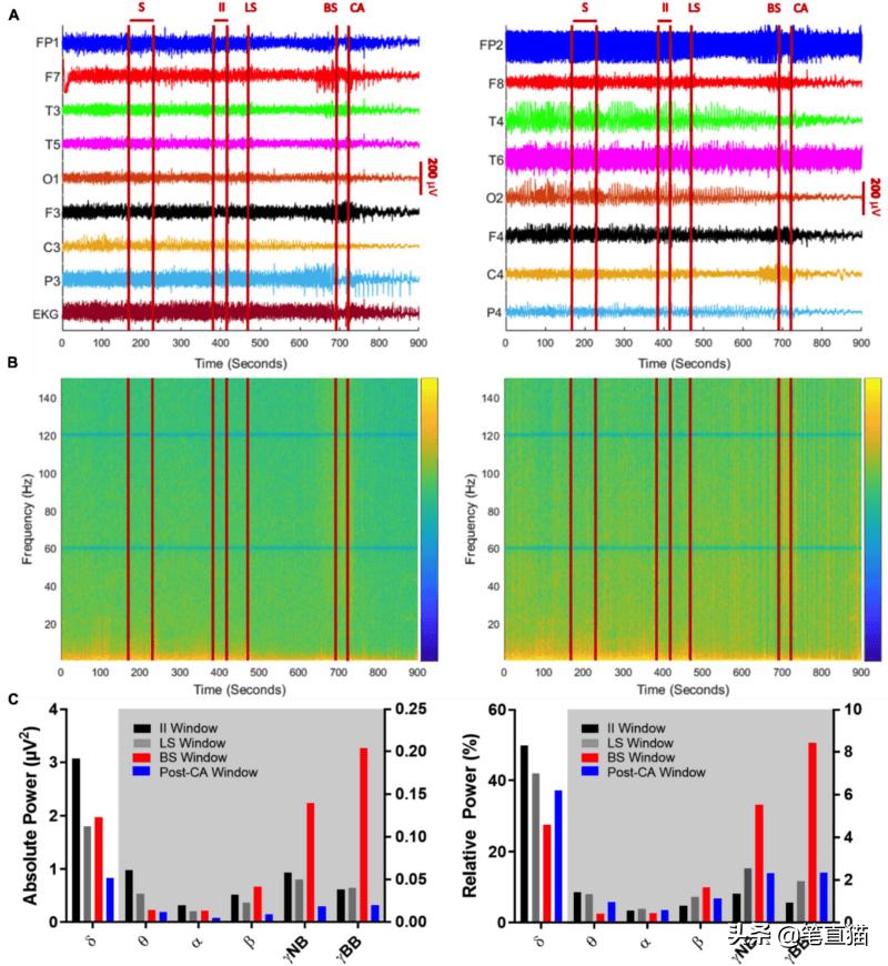 医学家揭秘人在死亡瞬间的感觉,科学证明人类死了要去哪里
