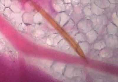 收走蚊子的作案工具,没收蚊子的工具