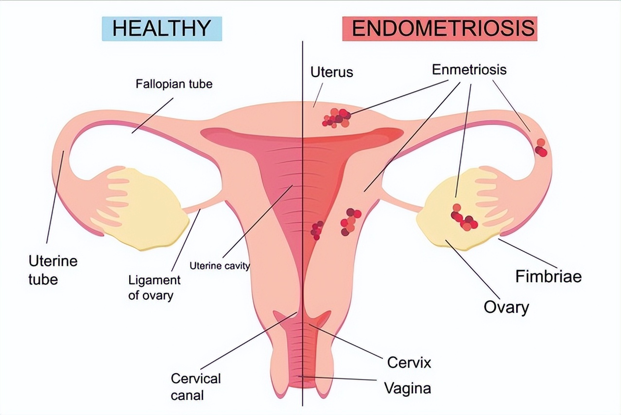 妇科检查前的小常识了解一下,妇科检查前不要犯这些低级错误