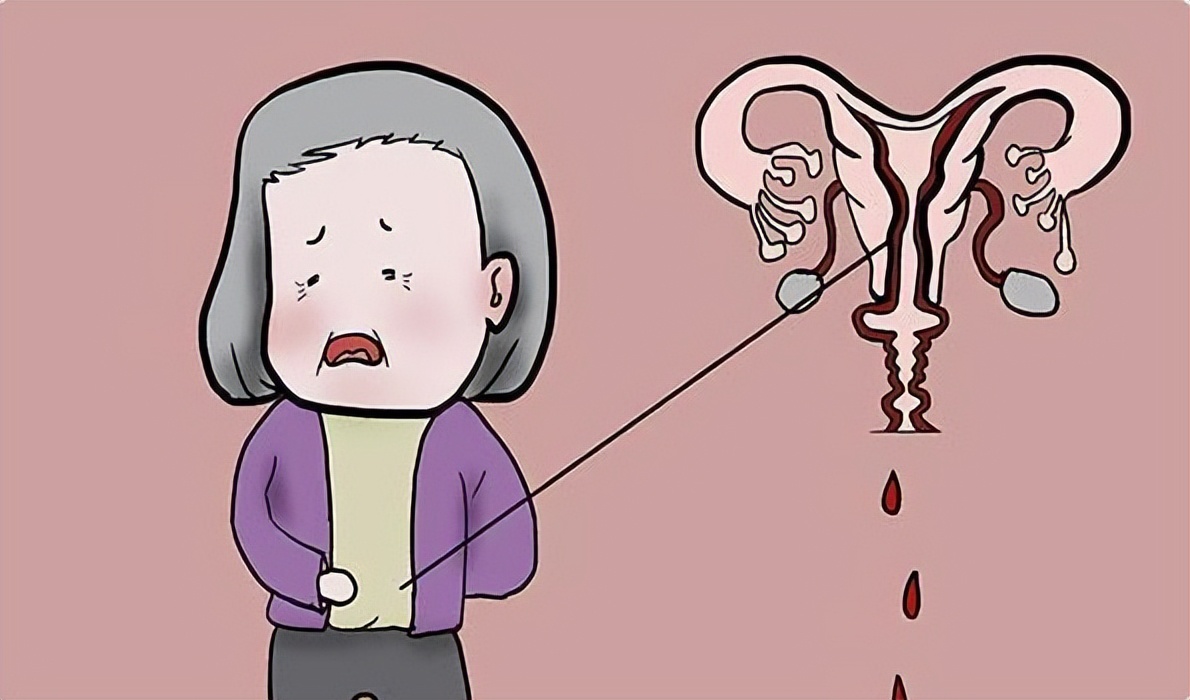 没了子宫的女人案例,没有子宫的女人和正常女人的区别