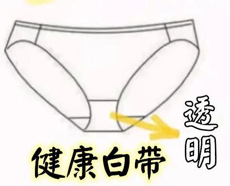 令人困扰的阴道炎，到底拿你怎么办？