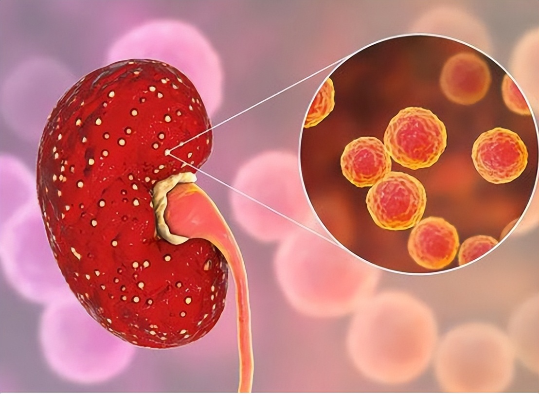 慢性病造成的肾脏伤害怎么治疗,自身免疫性疾病会引起哪些病