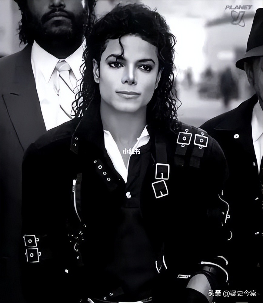 迈克尔杰克逊曾患有白癜风吗,迈克杰克逊去世真相