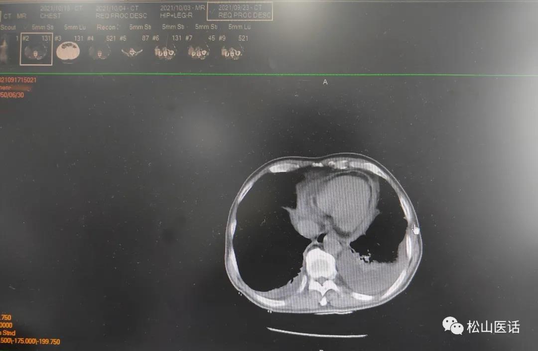 松山医话最新消息,松山医话系列之血液