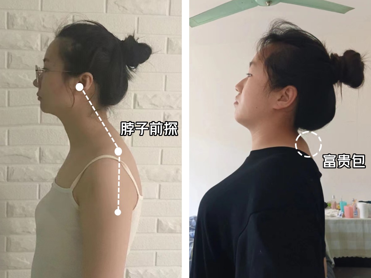 如何让自己的体态变好看,如何打造一副完美体态