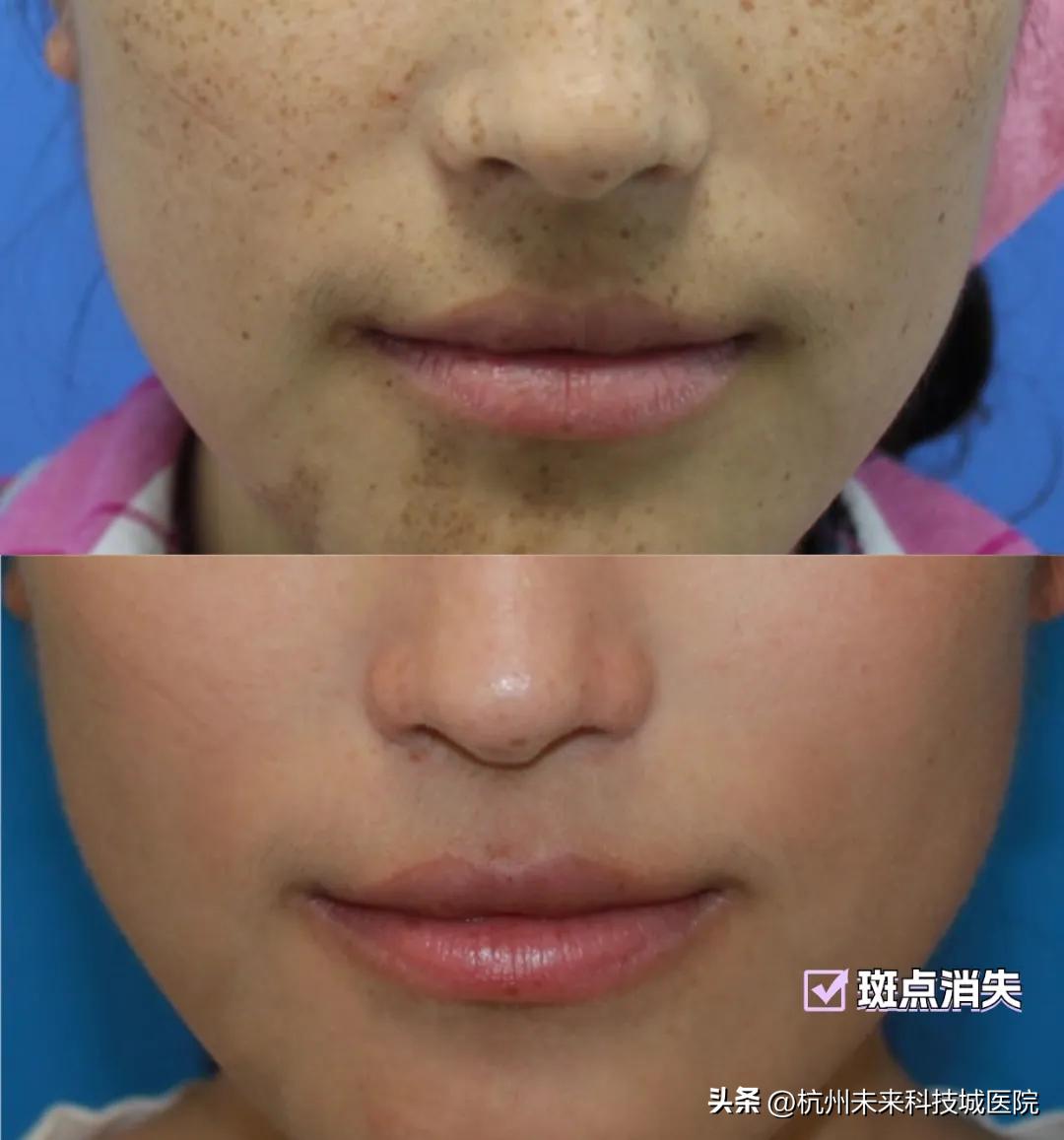 不追求一个模板的复制美|17年专注年轻化专家