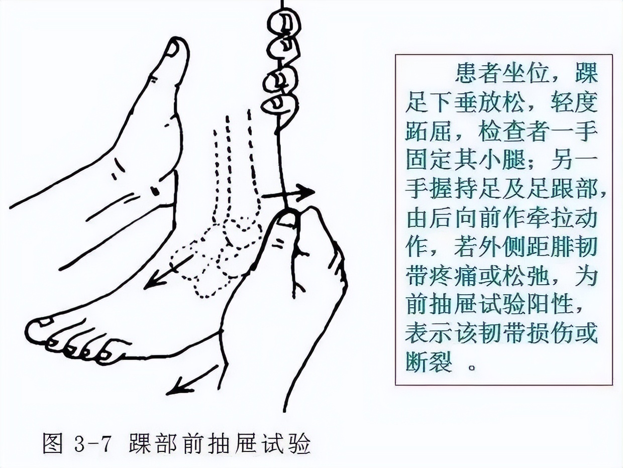 常见运动损伤及处理方法教案,体育课常见运动损伤及处理