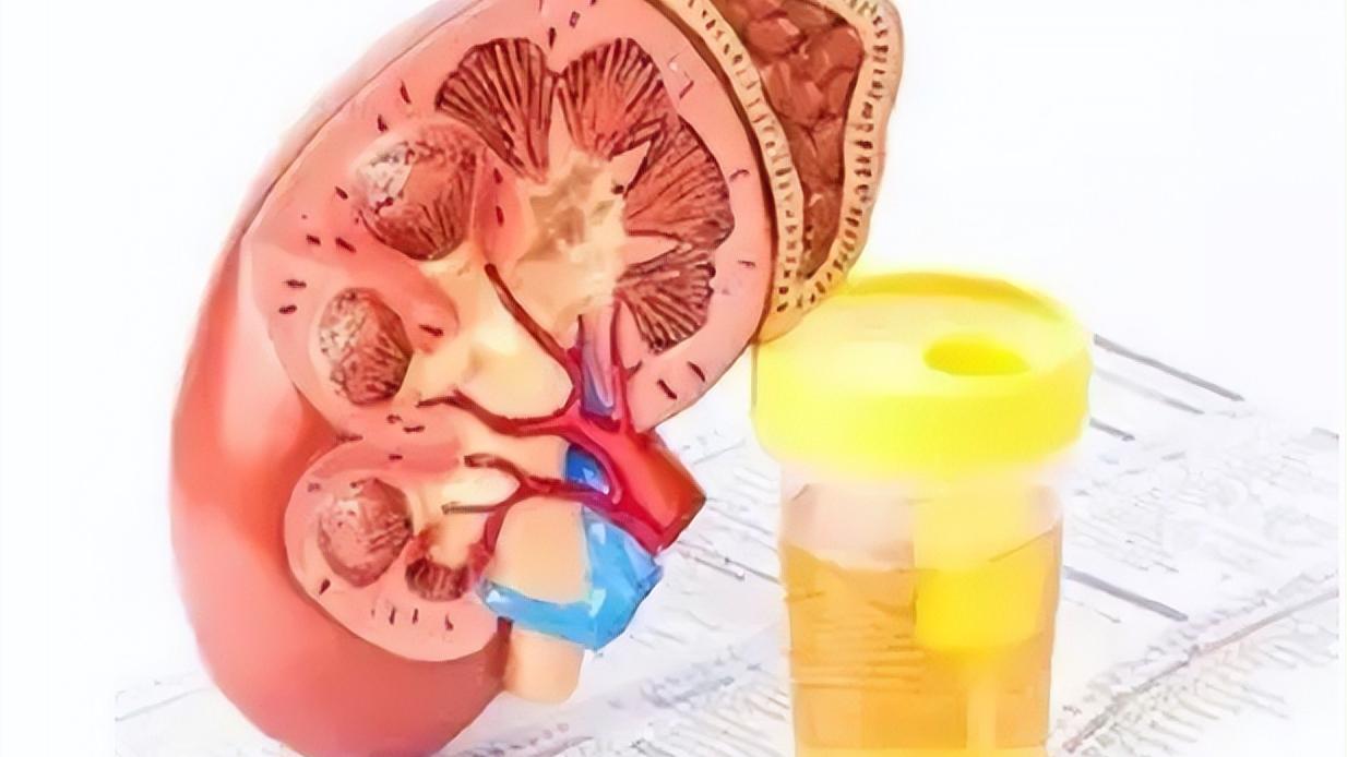 尿蛋白越高治疗好后复发几率越高,肾病尿蛋白高怎么办怎么能降下去