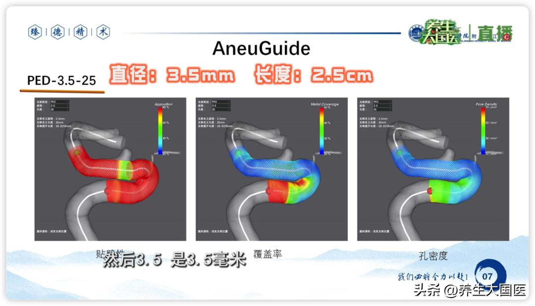 卒中危险因素有哪些,卒中全程管理