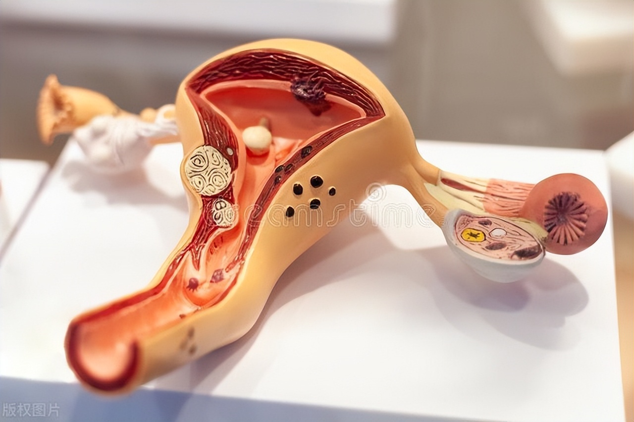 为什么要进行私密整形,私密整形话题