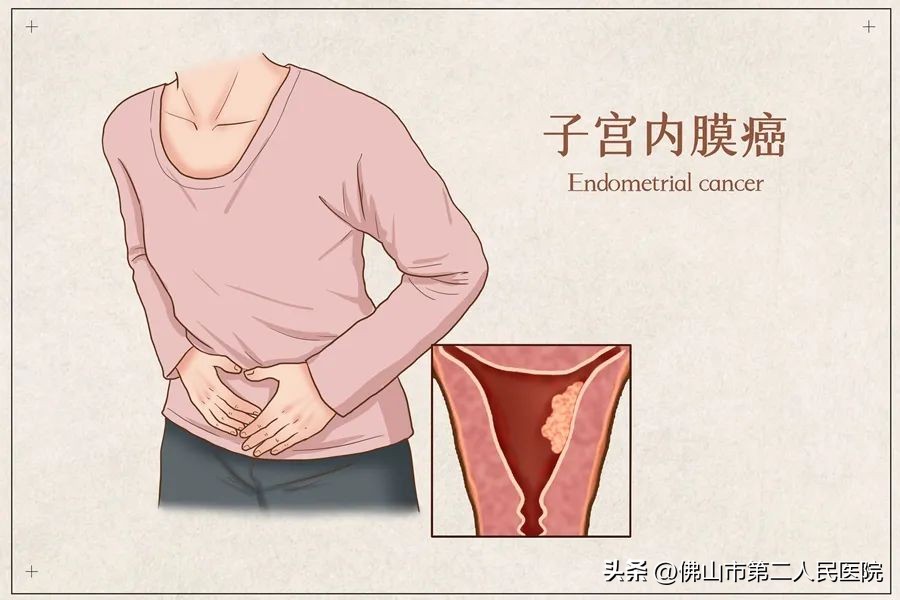 关爱女性健康非经期出血,关爱女性宫腔健康