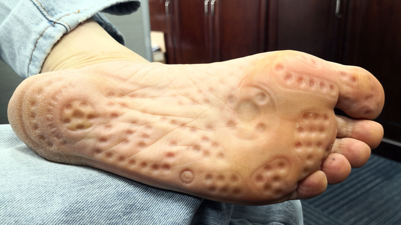 足底按摩袜有用吗,足疗袜靠谱吗