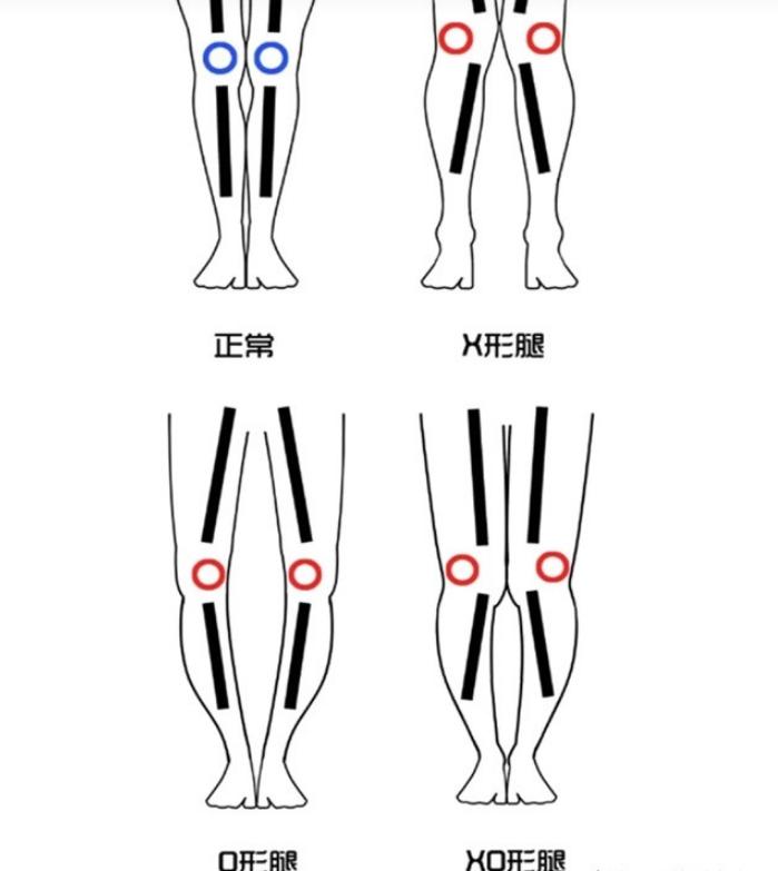 大腿和臀部胖的穿什么裤子合适,大腿粗的女生适合穿什么类型裤子