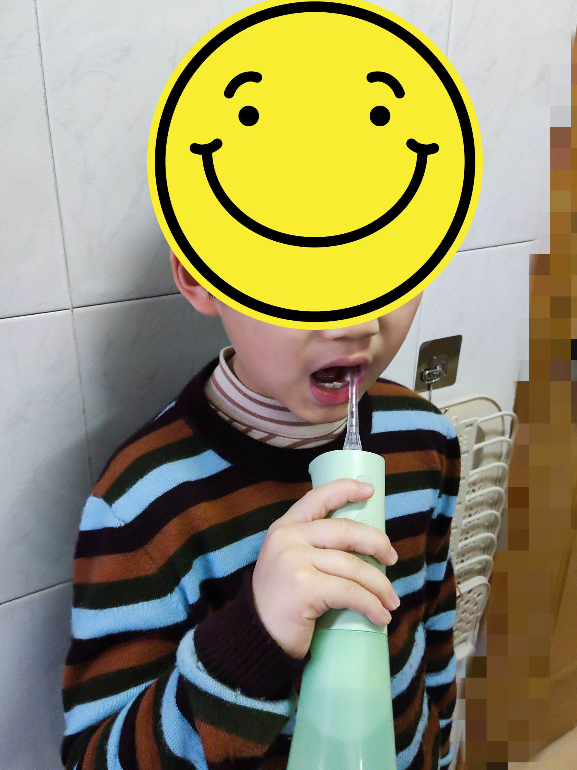 小孩换牙可以戴矫正器吗,小孩换牙时能用电动牙刷吗