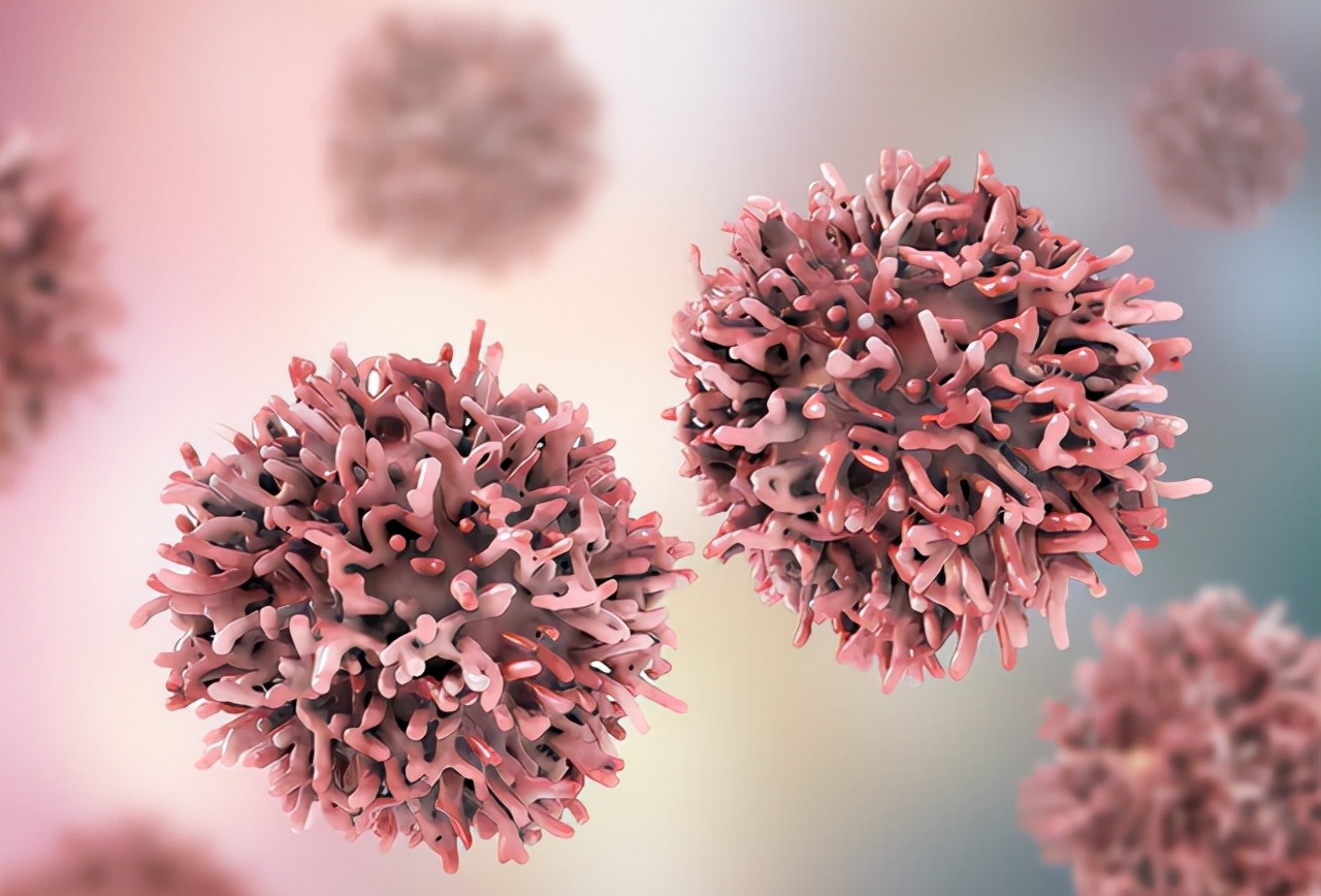 有个小囊肿要注意什么,医生诊断囊肿就一定是囊肿吗