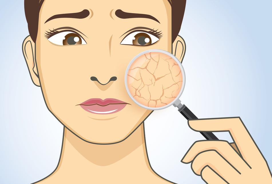 鹤叔脂溢性皮炎治疗方法合集,激素依赖性皮炎最好的治疗方法