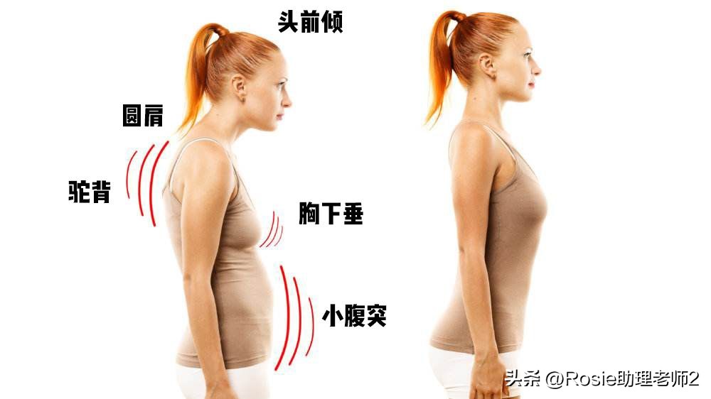 黎姿的下巴怎么改善的,黎姿面部变化