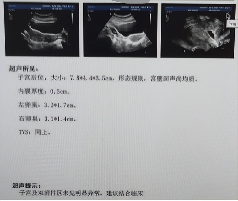 输卵管梗阻，身体可能会“冒出”这些症状，其中不孕是个大问题