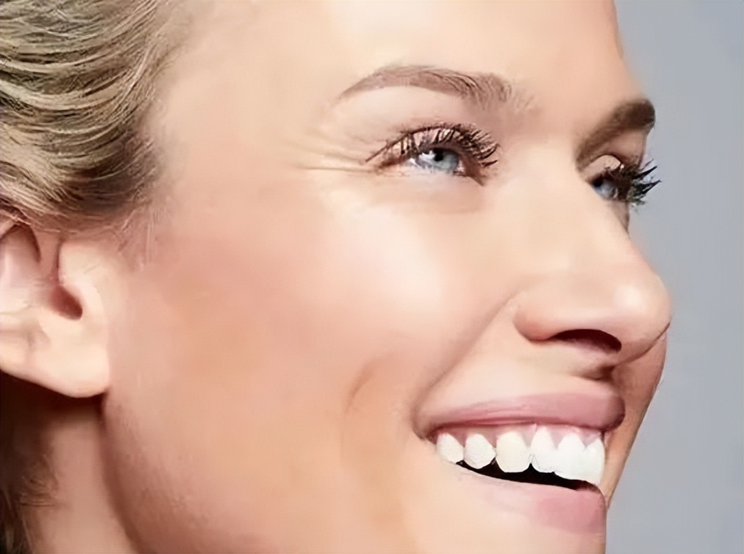 有效去黑眼圈和泪沟方法,黑眼圈泪沟抗衰老