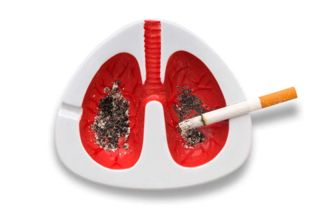 浙江首例！医生用钝头微波消融针为8旬老人“烫死”高危肺结节