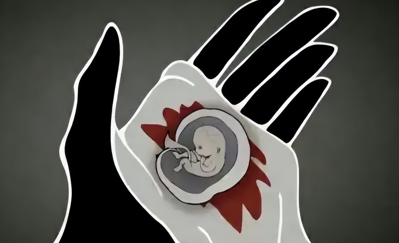 罗马尼亚生育税,罗马尼亚生育干预后果