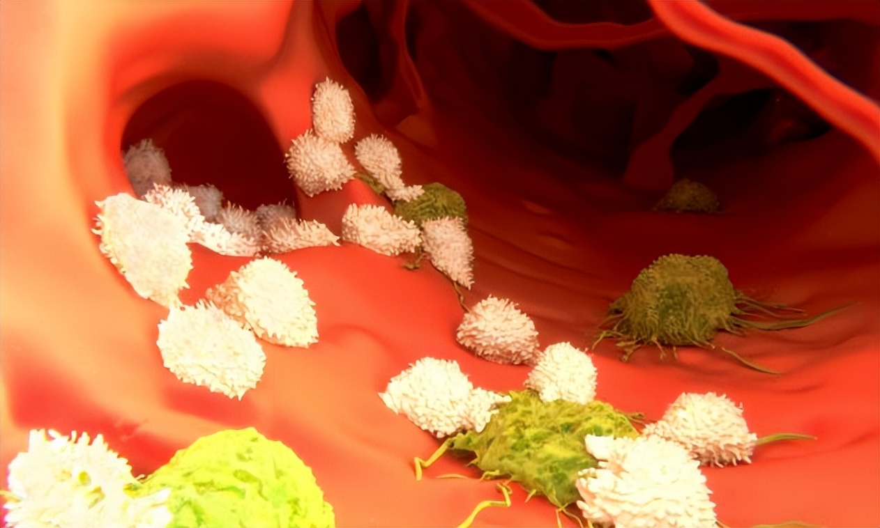 过敏性紫癜出血点越来越多,过敏性紫癜出血点的特征是怎样的