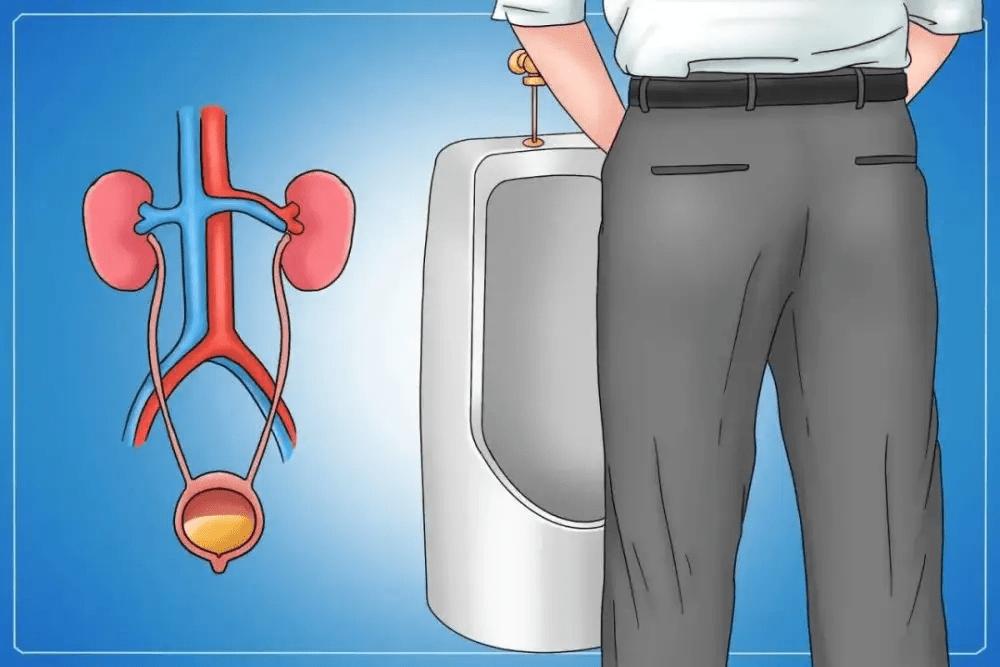 前列腺痛表现症状有哪些,前列腺突然非常疼吃什么药能缓解