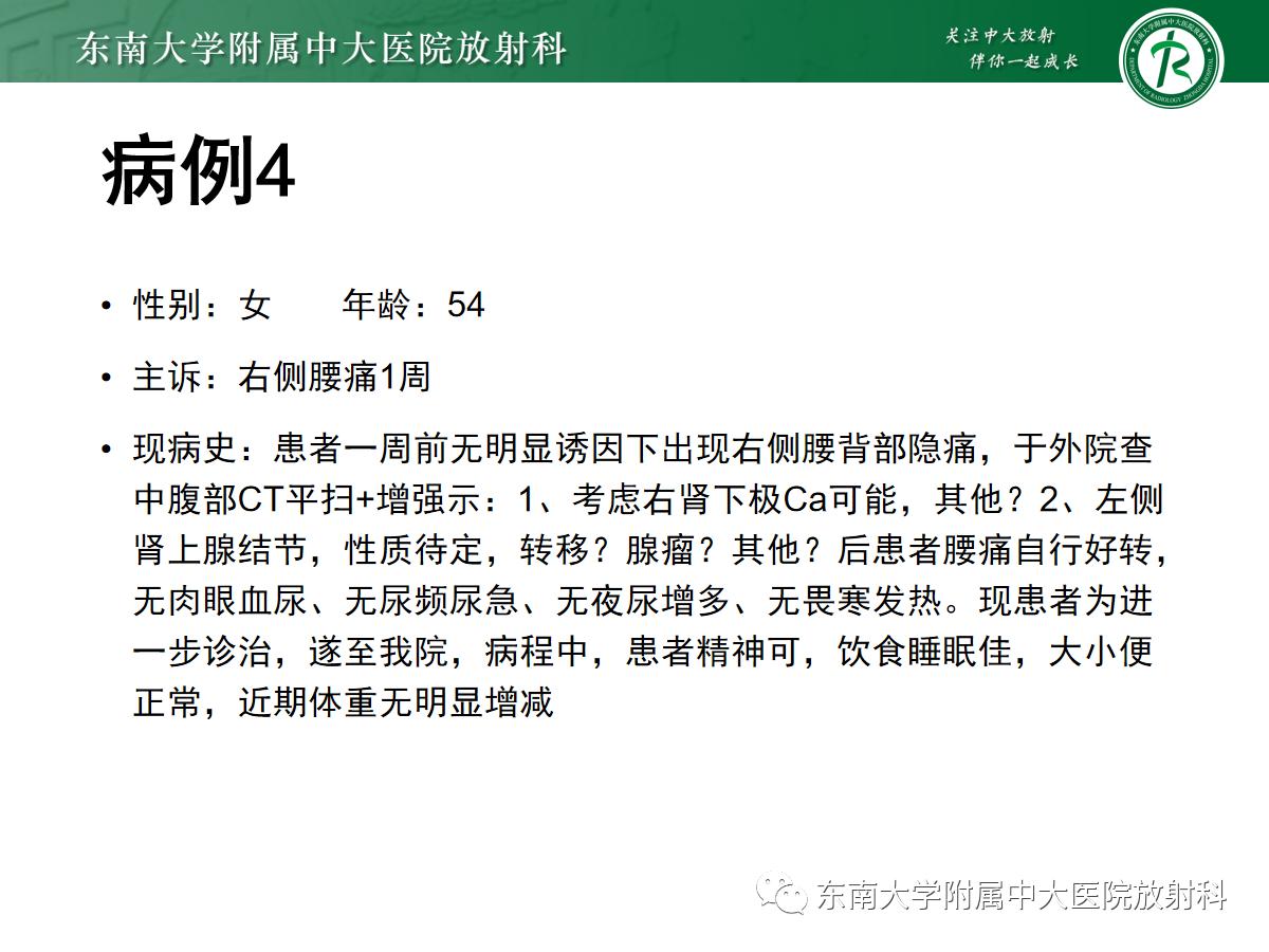 周利群谈肾嫌色细胞癌ct特点,好文分享值得深思